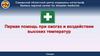 Первая помощь при ожогах и воздействии высоких температур. СОЦМК