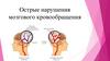 Острые нарушения мозгового кровообращения