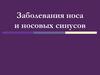 Заболевания носа и носовых синусов