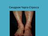 Синдром Чарга-Стросса
