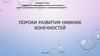 Пороки развития нижних конечностей