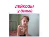 Лейкозы у детей