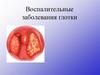 Воспалительные заболевания глотки