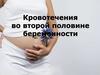 Кровотечения во второй половине беременности