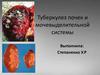 Туберкулез почек и мочевыделительной системы