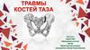Травмы костей таза