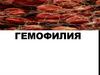 Гемофилия