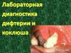Лабораторная диагностика дифтерии и коклюша