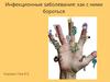 Инфекционные заболевания: как с ними бороться