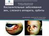 Воспалительные заболевания век, слезного аппарата, орбиты