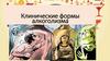 Клинические формы алкоголизма