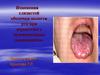 Дерматозы. Изменения слизистой оболочки полости рта при дерматозах с аутоиммунным компонентом