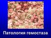 Патология гемостаза