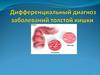 Дифференциальный диагноз заболеваний толстой кишки