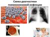 Схема диагностики пневмококковой инфекции