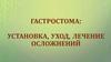 Гастростома: установка, уход, лечение осложнений