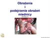Obrażenia i podejrzenie obrażeń miednicy (procedura 11)