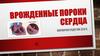 Врожденные пороки сердца