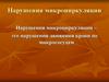Нарушения микроциркуляции