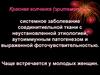 Красная волчанка (эритематоз) – системное заболевание соединитиельной ткани с неустановленной этиологией, аутоиммунным