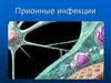 Прионные инфекции