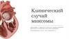 Клинический случай миксомы