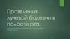 Проявления лучевой болезни в полости рта