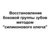 Восстановление боковой группы зубов методом "силиконового ключа"