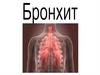 Острый бронхит