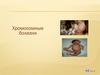 Хромосомные болезни