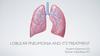 Lobular pneumonia and it’s treatment