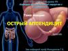 Острый аппендицит
