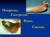 Некрозы. Гангрены. Язвы. Свищи